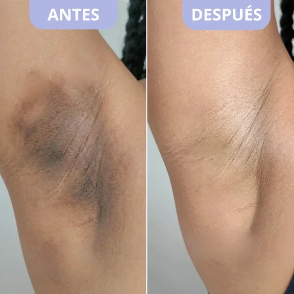 Exfoliante Corporal para Zonas Oscuras – Dr. Melaxin (200ml) ORIGINAL.....GRATIS Crema corporal para hidratar.