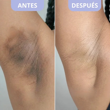 Exfoliante Corporal para Zonas Oscuras – Dr. Melaxin (200ml) ORIGINAL.....GRATIS Crema corporal para hidratar.