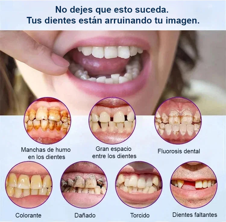Prótesis Dental Completa con Soporte Esquelético (Sonrisa Firme y Natural)